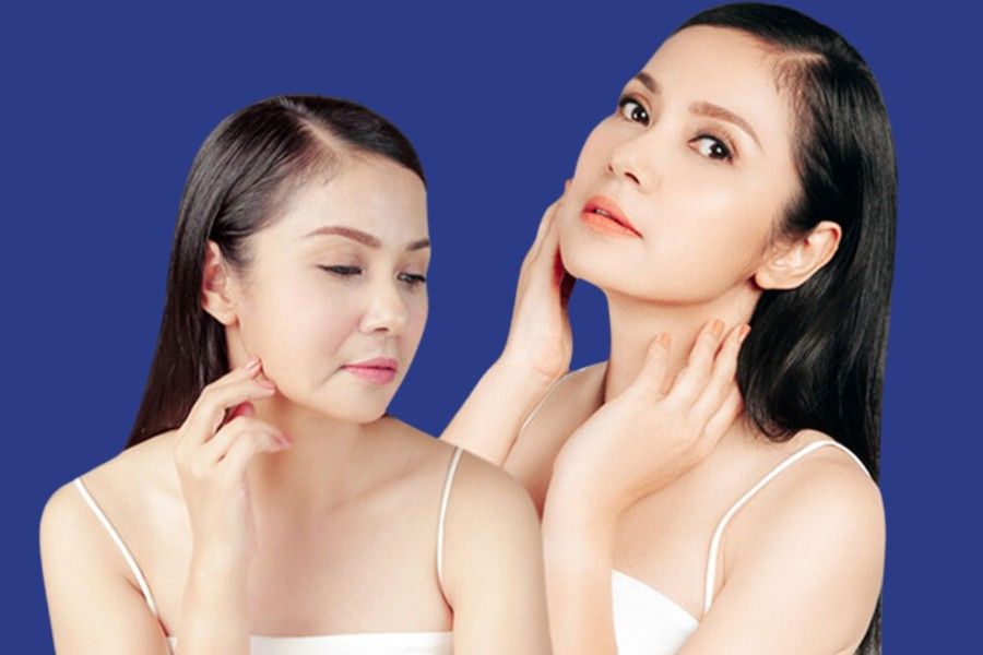 Hình ảnh khách hàng “lột xác” trước và sau khi thải độc da