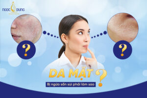 da mặt bị ngứa sần sùi phải làm sao