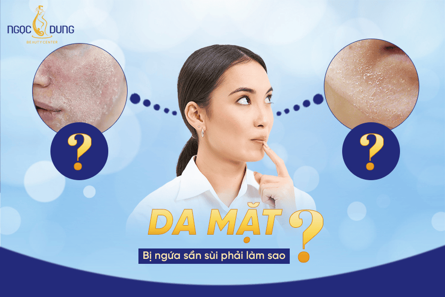 Da mặt bị ngứa sần sùi phải làm sao? 