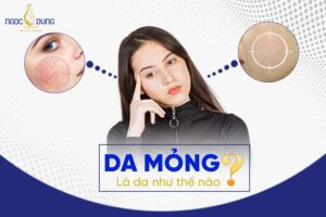 Da mỏng là da như thế nào