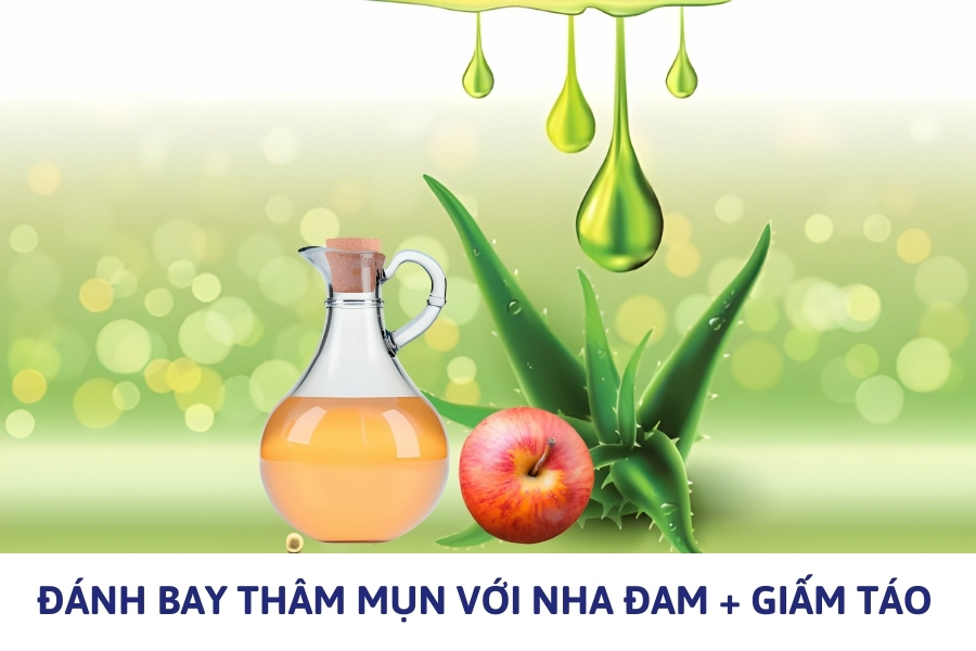 Mẹo giảm mụn thâm nhanh chóng với giấm táo và nha đam