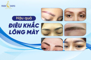Hậu quả điêu khắc lông mày giá rẻ, tại cơ sở kém chất lượng