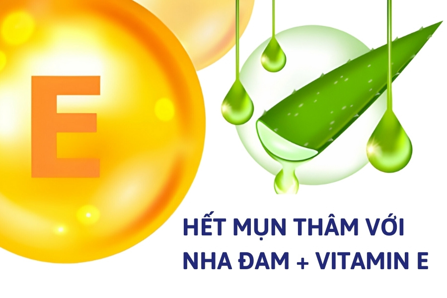 Giảm sắc tố, mờ thâm mụn với vitamin E và nha đam