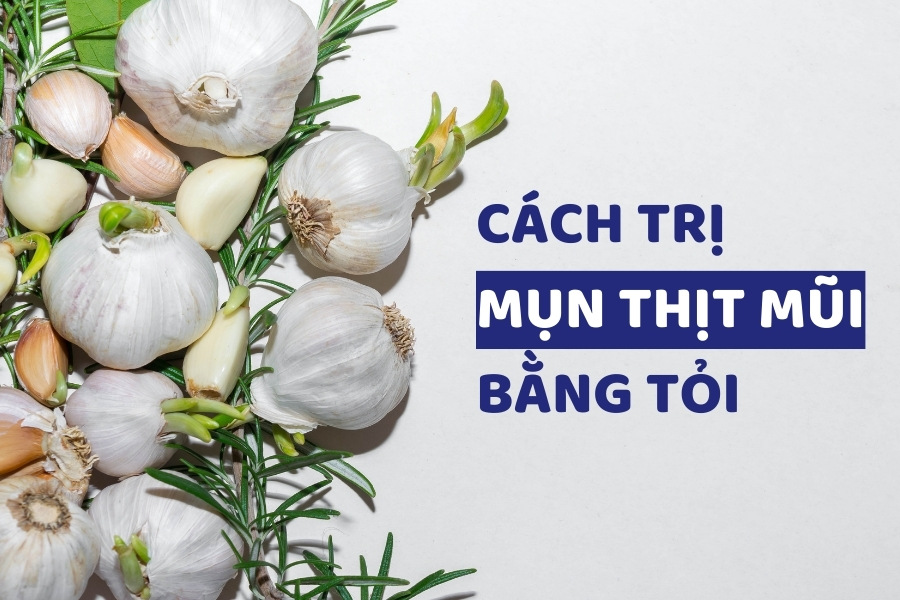 Có thể dùng tỏi để chữa mụn thịt mũi do trong tỏi có chứa emzym kháng khuẩn