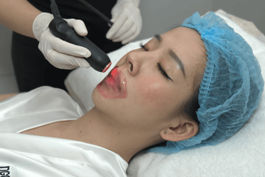 Khử thâm môi bằng công nghệ cao tại TMV Ngọc Dung