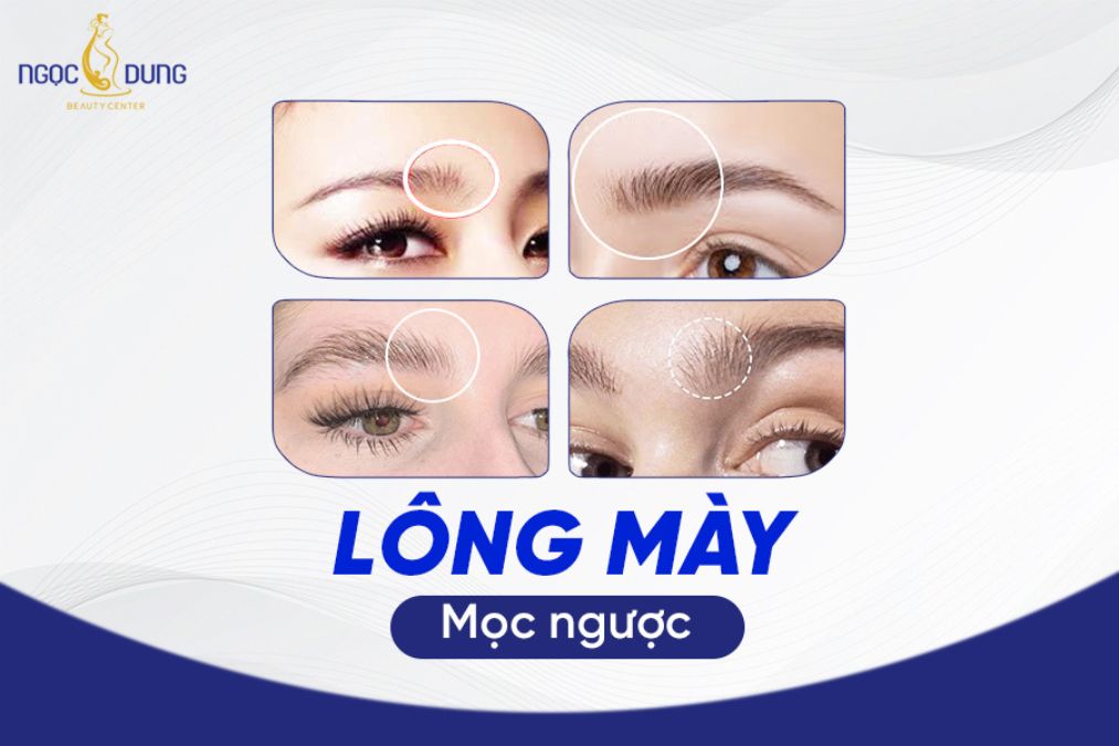 Lông mày mọc ngược là gì? Hãy cùng chuyên gia giải đáp ngay