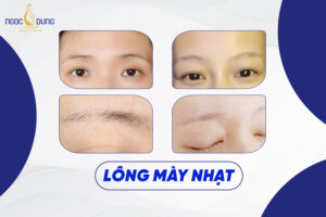 Nhìn tướng lông mày nhạt - Đoán chuẩn vận mệnh cuộc đời