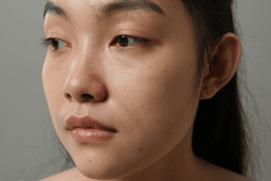 Mắt không được chăm sóc kịp thời sẽ bị sẫm màu và hình thành nếp nhăn 