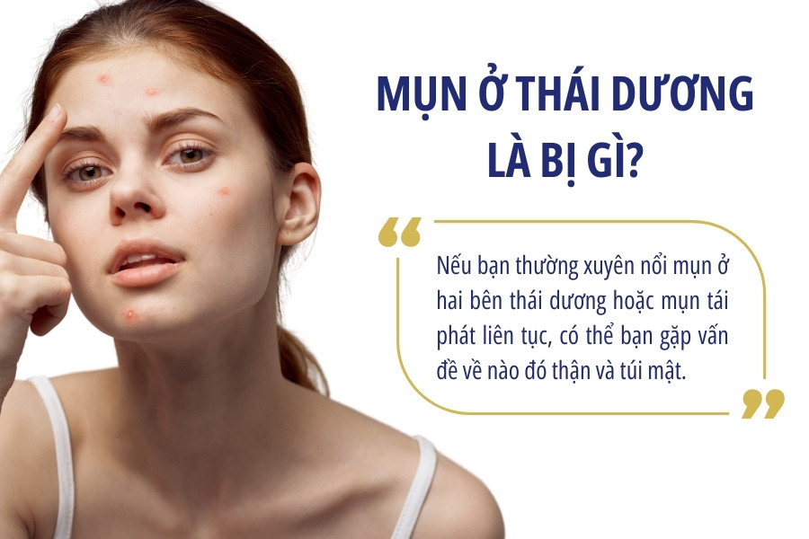 Bị mụn ở thái dương có thể là dấu hiệu cho thấy thận và túi mật đang gặp vấn đề