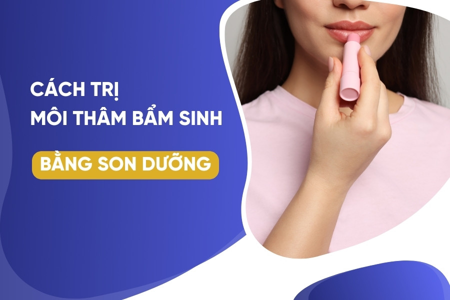 son dưỡng môi chuyên trị thâm môi bẩm sinh