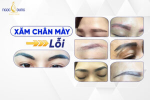 Xăm chân mày lỗi: Nguyên nhân và cách khắc phục hiệu quả