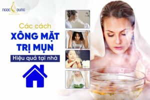 Mặt mụn có nên xông mặt không? Tổng hợp các cách xông mặt trị mụn siêu hiệu quả