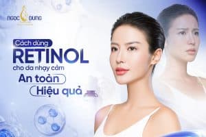 20260320 Pos SEO 1308