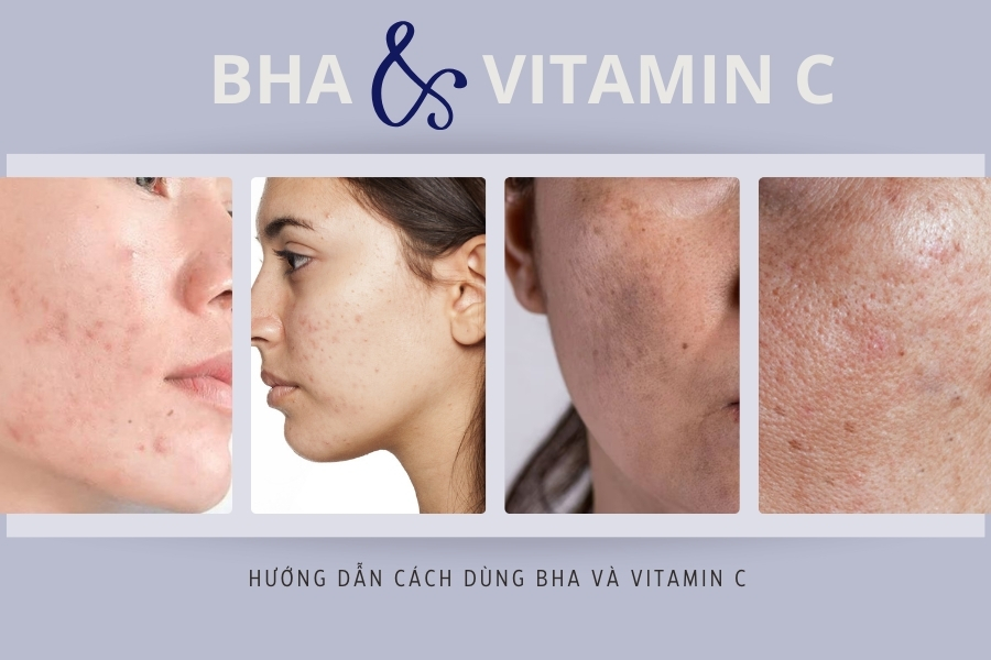 Cách dùng BHA và Vitamin C trong skincare khoa học