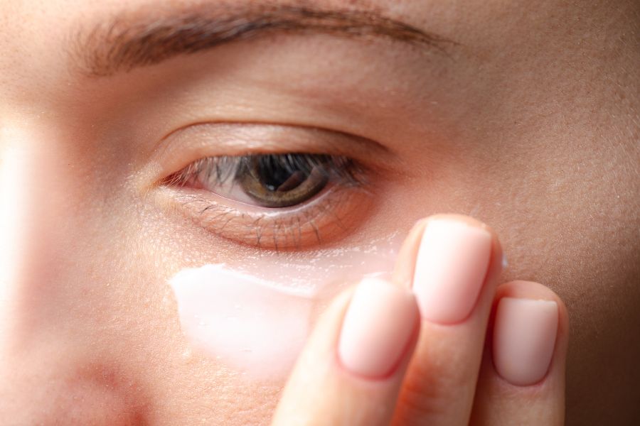 Dùng kem đặc trị để điều trị bọng mắt là phương pháp điều trị nhanh chóng, hiệu quả