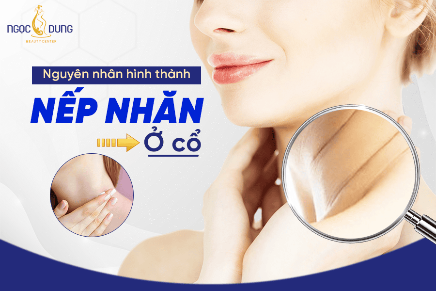 Các phương pháp xóa nếp nhăn ở cổ hiệu quả 