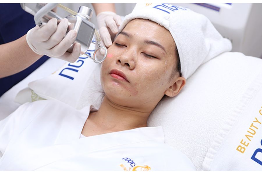 Điều trị đốm nâu bằng công nghệ ưu việt, mang lại hiệu quả tốt nhất tại Ngọc Dung beauty