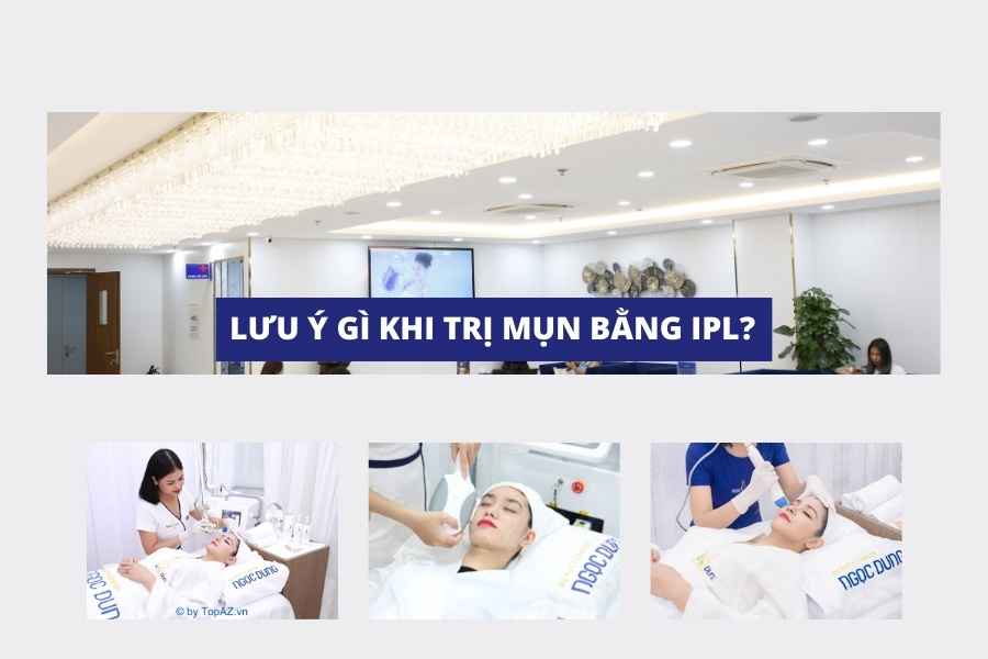 Một số lưu ý khi trị mụn bằng công nghệ IPl mà bạn cần nắm