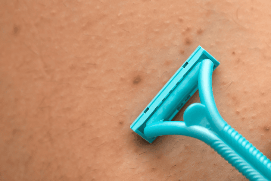 Viêm lỗ chân lông ở tay: Nguyên nhân, dấu hiệu và cách điều trị hiệu quả 5 Cạo lông tay không đúng quy trình gây suy yếu hàng rào bảo vệ da