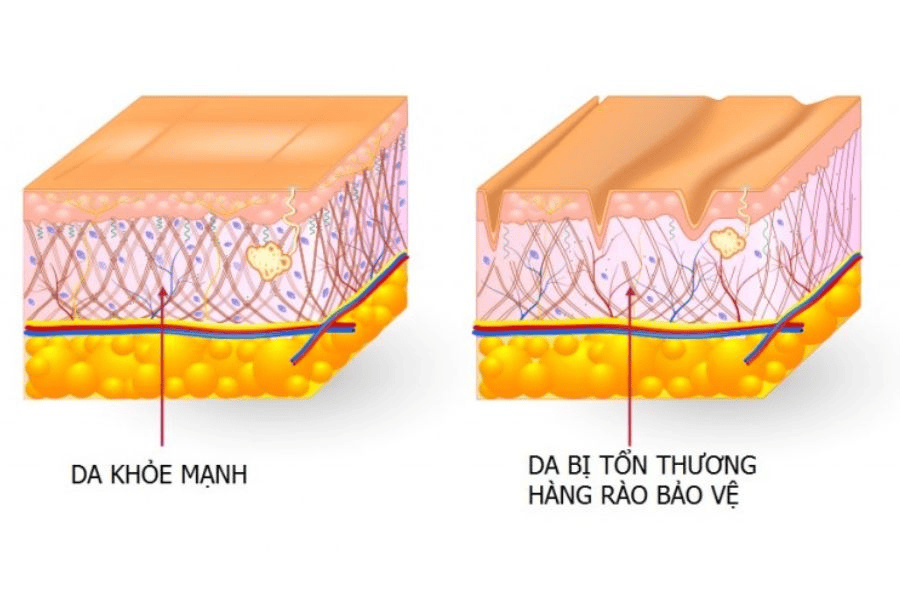 Cấu trúc của hàng rào bảo vệ da thường được mô tả theo mô hình "gạch và vữa"