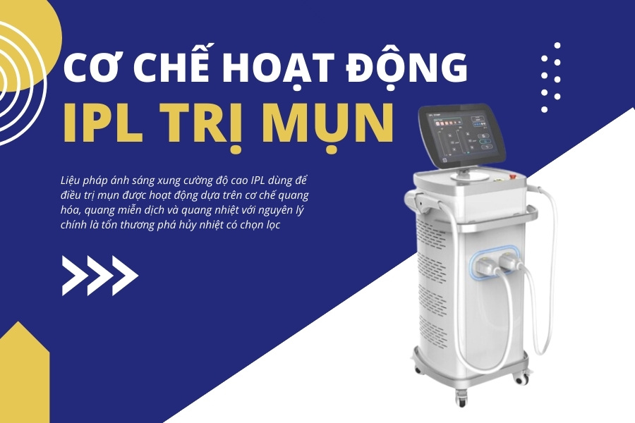 IPL trị mụn hoạt động theo cơ chế quang hóa