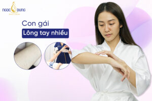 Con gái lông tay nhiều