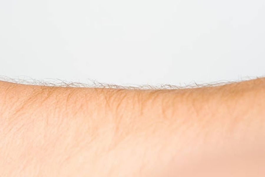 Sự phát triển của lông chịu ảnh hưởng trực tiếp từ hormone androgen