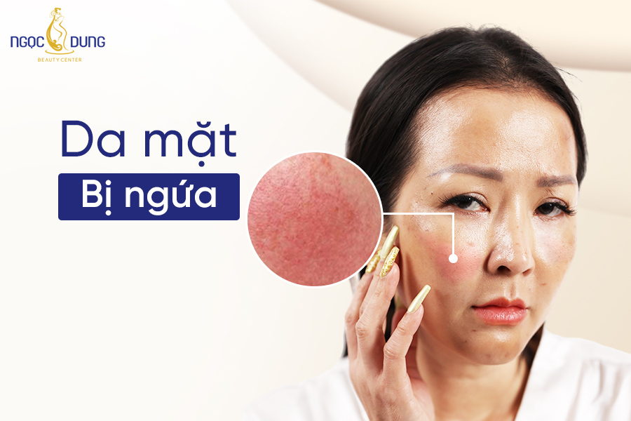 da mặt bị ngứa