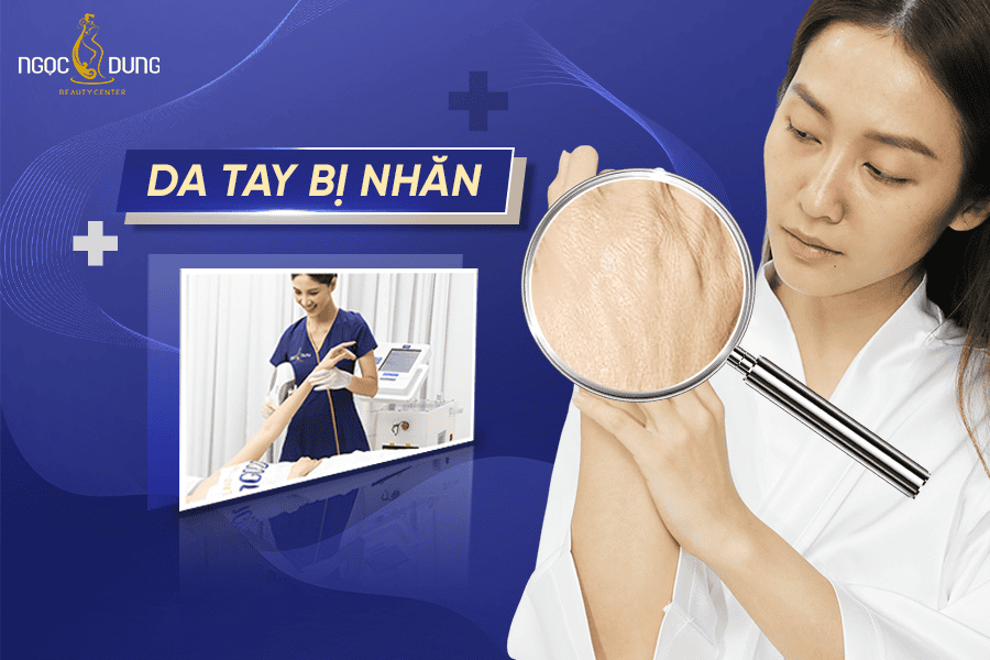 da tay bi nhan phai lam sao co anh huong toi tham