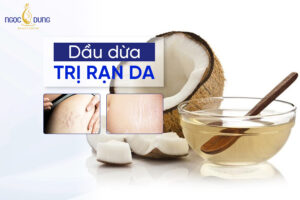 dầu dừa trị rạn da