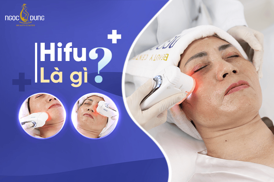 Đỉnh cao trẻ hóa da chuyên nghiệp bằng công nghệ HIFU 