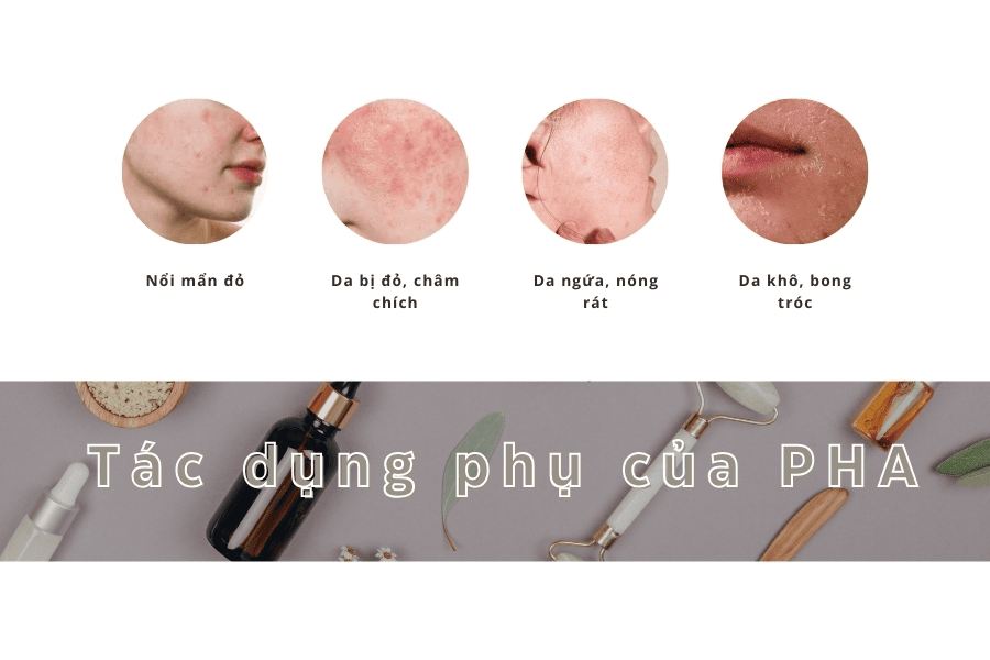 PHA là gì trong mỹ phẩm? Công dụng và hướng dẫn sử dụng 14 Dù có rất nhiều tác dụng nhưng PHA cũng gây ra những tác dụng phụ không đáng có