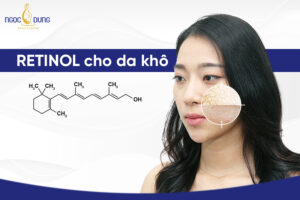 Cách dùng Retinol cho da khô và nhạy cảm tránh kích ứng da