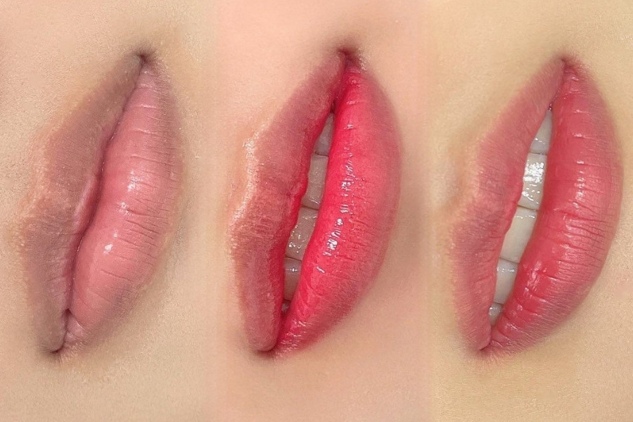 Hình ảnh trước và sau khi phun môi