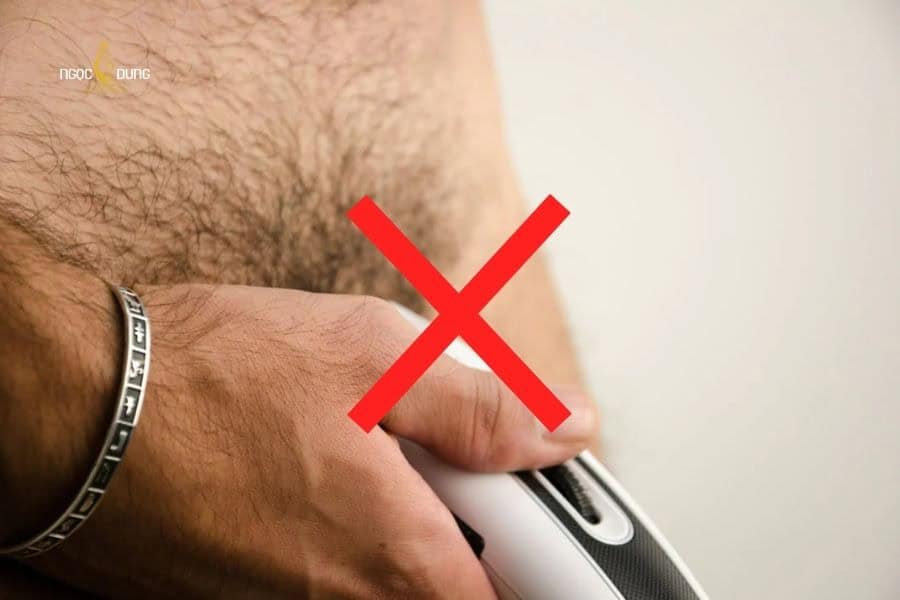 Nên dừng cạo lông vùng kín nam khi da bị kích ứng