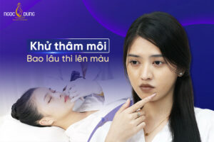 Khử thâm môi bao lâu thì lên màu? Ăn gì để môi lên màu nhanh?