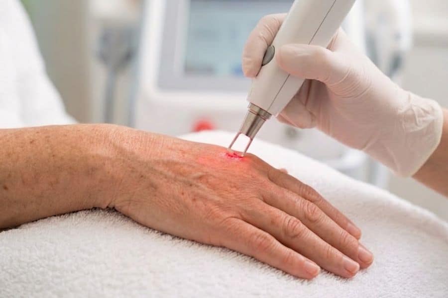 Tác động của năng lượng ánh sáng Laser giúp phá vỡ hắc sắc tố Melanin tích tụ dưới da