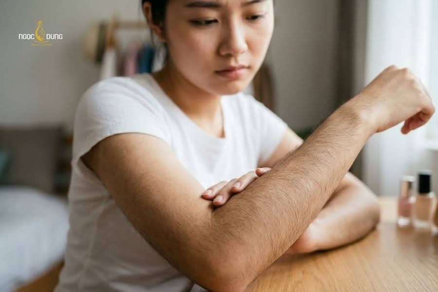 Con gái lông tay nhiều: Nguyên nhân và cách khắc phục 4 Lông tay mọc nhiều và dày gây mất thẩm mỹ