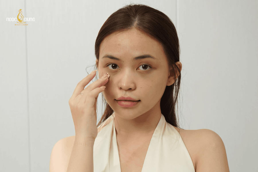 Lý do ngủ sớm nhưng mắt vẫn thâm thường liên quan tới cơ địa của mỗi người