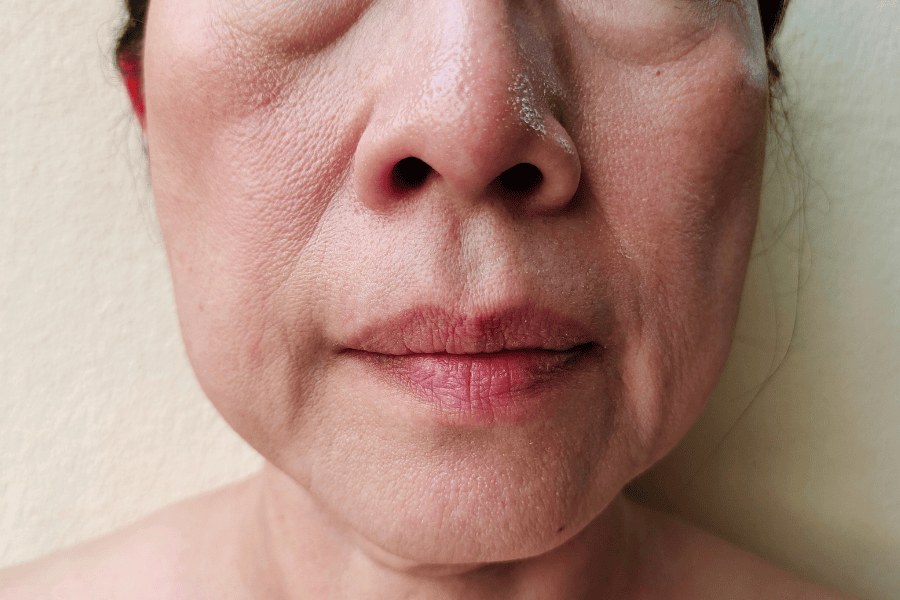 Người trong độ tuổi từ 25-55 đang có dấu hiệu lão hóa bắt đầu xuất hiện nên sử dụng dịch vụ nâng cơ trẻ hóa HIFU