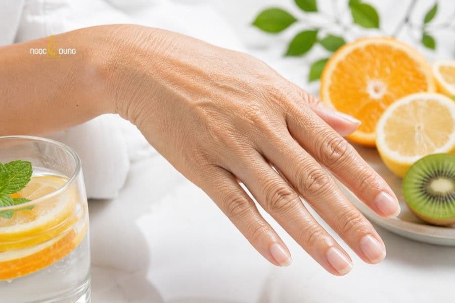 Thiếu vitamin C thường gây ra tình trạng nhăn da tay