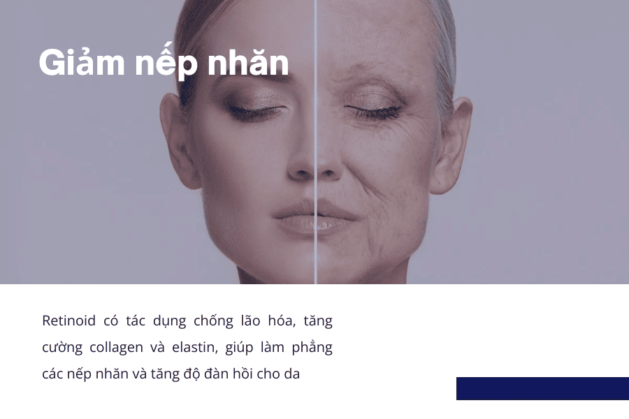 Retinoid giúp giảm nếp nhăn và chống lão hóa da