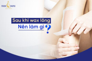 sau khi wax lông nên làm gì