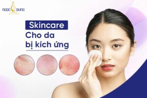 “Mách” nàng các bước skincare cho da bị kích ứng an toàn, đúng cách