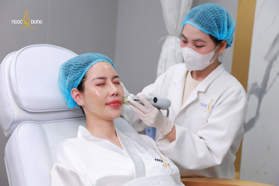 Điều trị tăng sắc tố sau peel bằng phương pháp ít xâm lấn