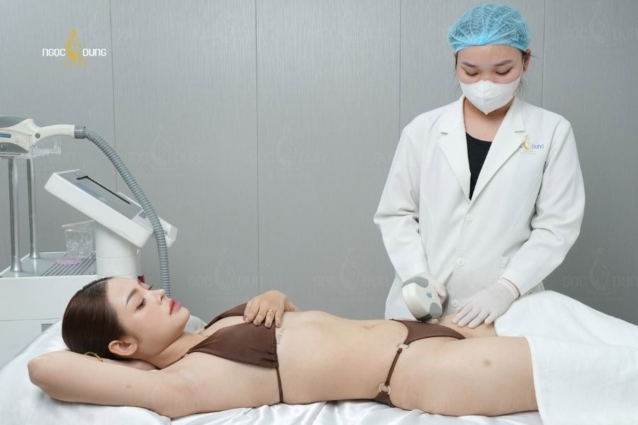 Hướng dẫn cách tỉa lông vùng kín nữ bằng kéo an toàn 21 Ngọc Dung là một trong những địa chỉ triệt lông uy tín và mang lại hiệu quả bền lâu