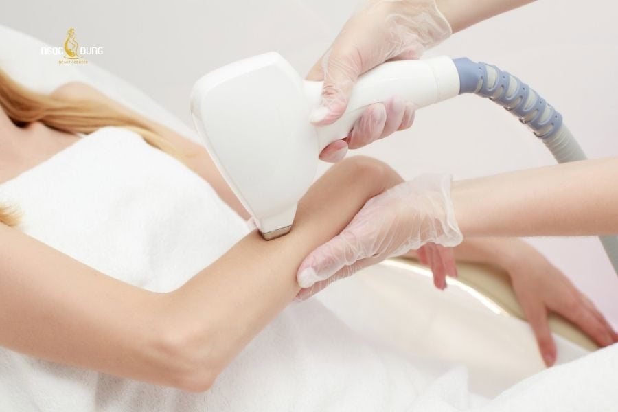 Con gái lông tay nhiều: Nguyên nhân và cách khắc phục 8 Triệt lông tay an toàn tại Ngọc Dung