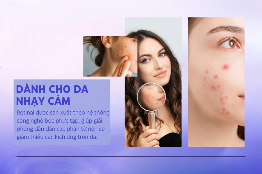 Hỗ trợ cho làn da nhạy cảm tốt hơn Retinol