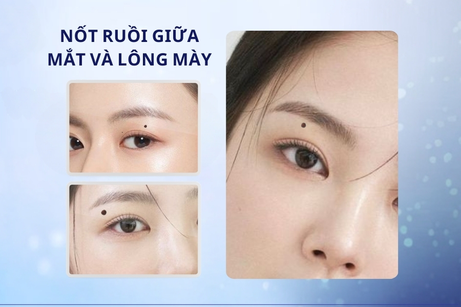 Nốt ruồi giữa mắt và lông mày - Trải qua hai, ba lần đò