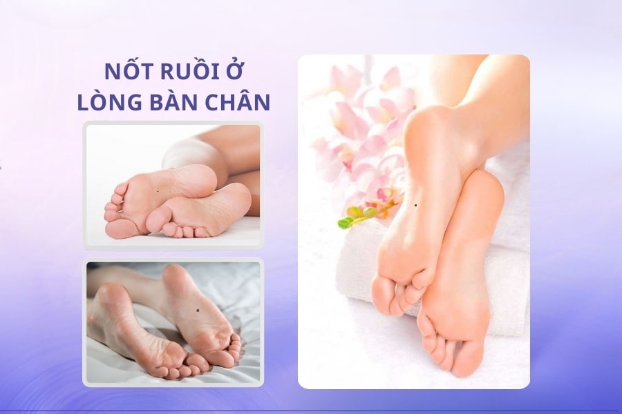 Nốt ruồi nằm ở lòng bàn chân - Chủ tài vận, số giàu sang